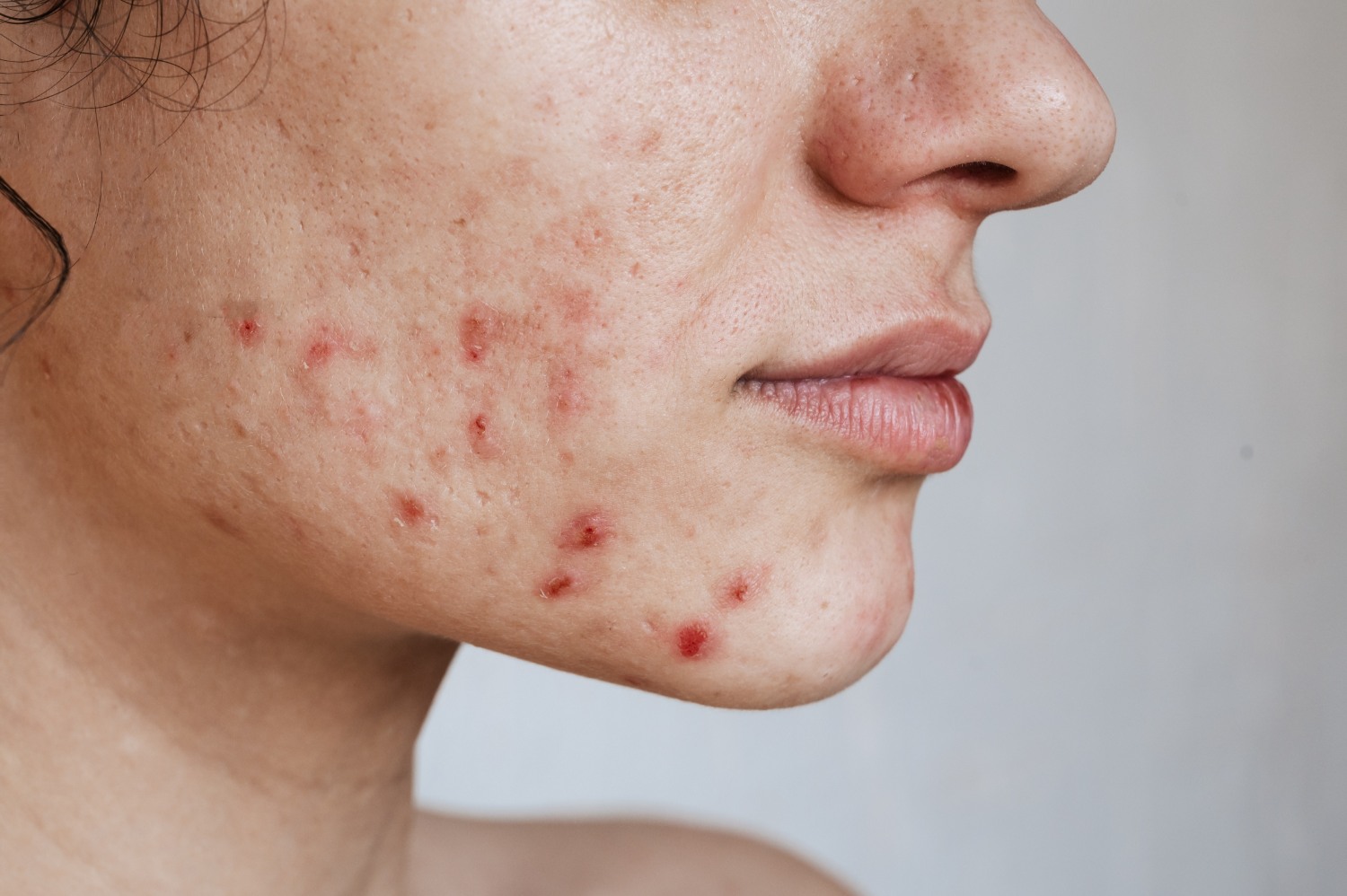 Dermatology Triage, Advice & Guidance Service