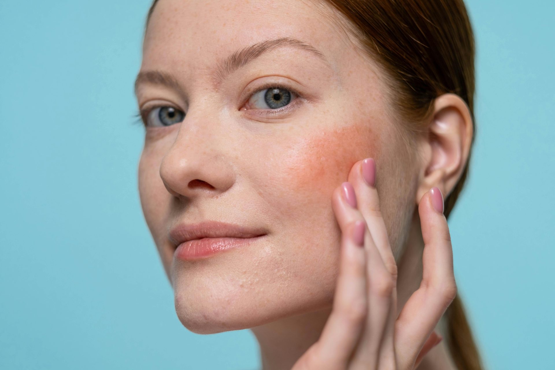 Dermatology Triage, Advice & Guidance Service